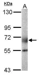 Anti-GALNT2 antibody used in Western Blot (WB). GTX104070